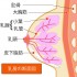 乳腺炎・おっぱいが痛くてつらい方へ